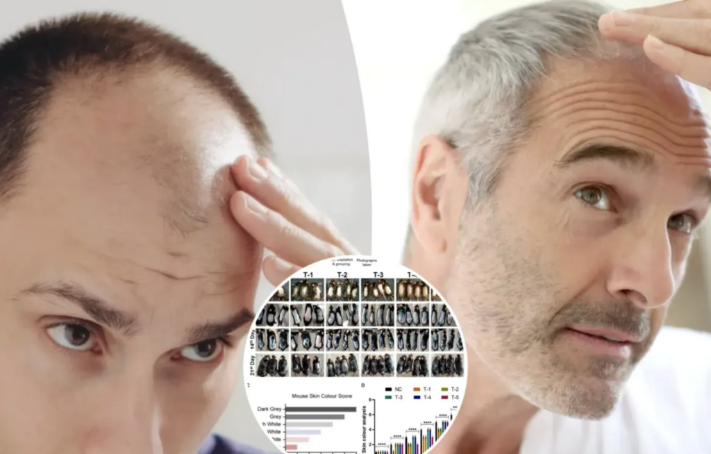 बालों के झड़ने के उपचार में Sugar Gel हो सकती है असरदार! शोधकर्ताओं ने किया खुलासा  